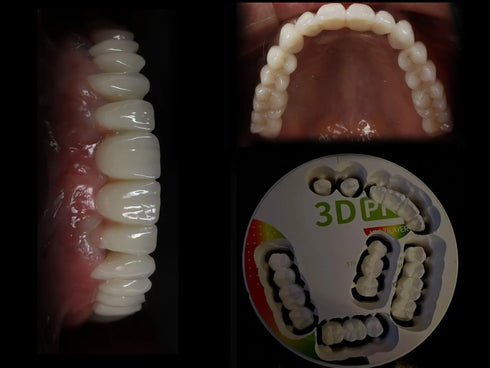 Multilayer Zirconia Block 3DPro Exceptional Strength 800-1200Mpa, 5 Layers Material Produces, All in One