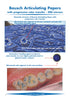 Bausch Arti-Check Micro-Thin 40μ 40 microns Blue Red Horseshoe Strips Progressive Color Transfer